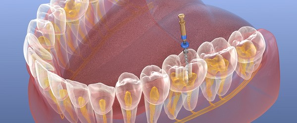 Endodontie